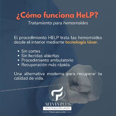 Cómo funciona HeLP