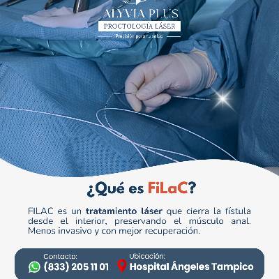 Qué es FiLaC