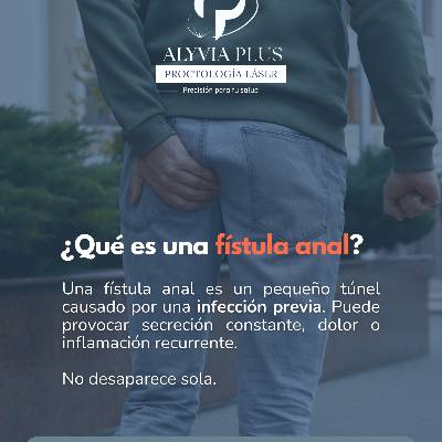 Qué es fístula anal